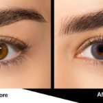 Charming-Blue colored contact lenses before and after