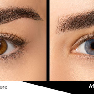 Dream Blue Natural Looking Blue Contact Lenses Before and after