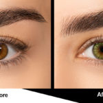 Green Contact Lenses Before and after